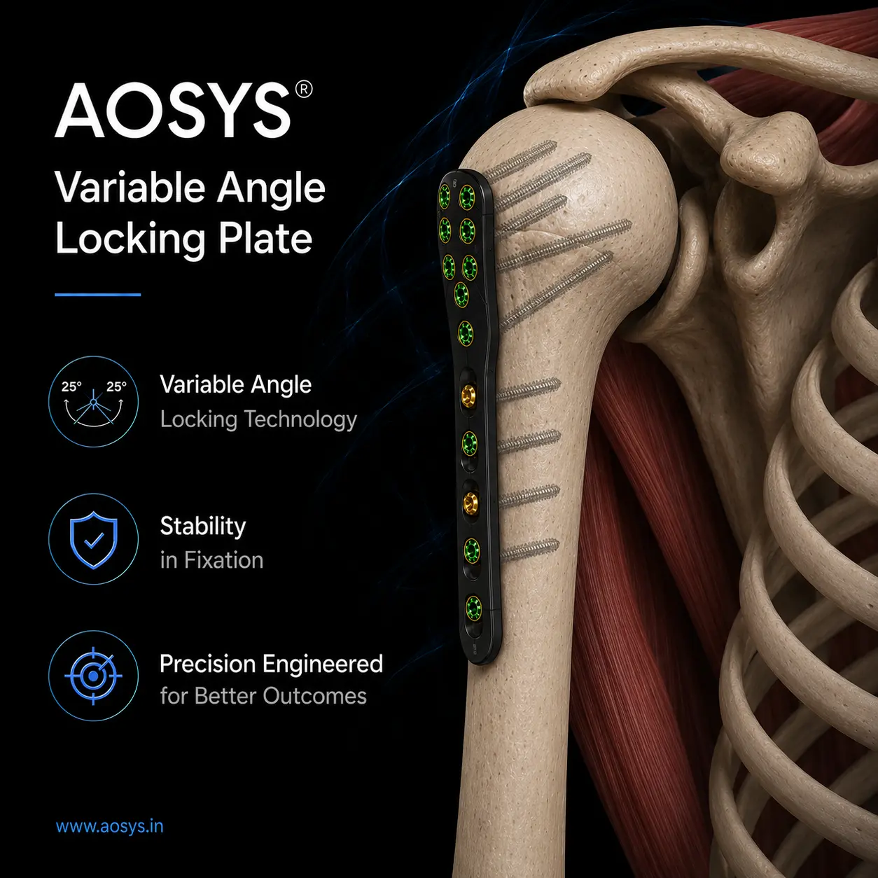 Variable Angle Locking Plate