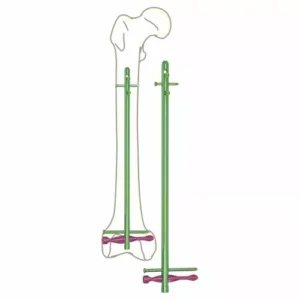 Distal Femoral Nail